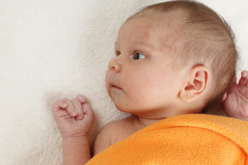 Особенности формы головы у новорожденных