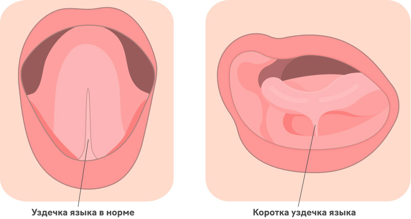 Проблемы в ротовой полости ребенка